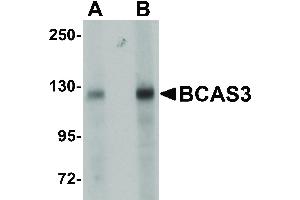 BCAS3 antibody  (N-Term)
