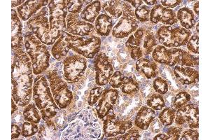 IHC-P Image ABAT antibody detects ABAT protein at mitochondria on mouse kidney by immunohistochemical analysis.