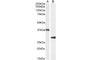 Image no. 2 for anti-Uncoupling Protein 2 (Mitochondrial, Proton Carrier) (UCP2) (Internal Region) antibody (ABIN5539644)