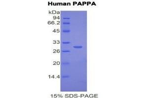 Image no. 1 for Pregnancy-Associated Plasma Protein A, Pappalysin 1 (PAPPA) (AA 317-532) protein (His tag) (ABIN1171176)