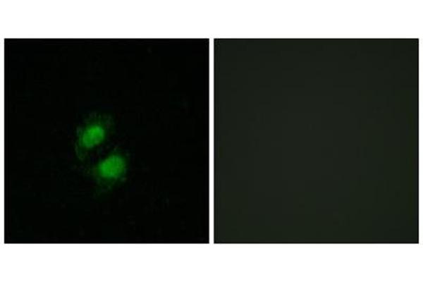 anti-Zinc Finger Protein 95 (ZNF95) (Internal Region) antibody
