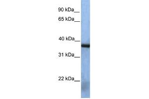 Image no. 1 for anti-N(alpha)-Acetyltransferase 30, NatC Catalytic Subunit (NAA30) (Middle Region) antibody (ABIN2783397)
