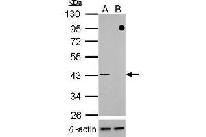 WB Image Western blot analysis of TDP-43 (, upper panel) and beta-actin , lower panel)  Sample (30 ug of whole cell lysate)   A: HeLa mock control  B: HeLa transfected shTDP-43 10% SDS PAGE  antibody diluted at 1:500