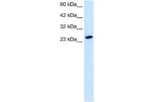 Image no. 2 for anti-TBP-Like 1 (TBPL1) (Middle Region) antibody (ABIN2776432)