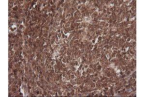 Image no. 6 for anti-Melanoma Antigen Family A, 4 (MAGEA4) antibody (ABIN1499260)