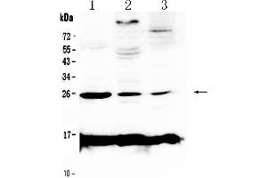 Image no. 1 for anti-C-Reactive Protein (CRP) (AA 20-225) antibody (ABIN5518820)