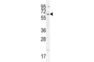 Image no. 1 for anti-Baculoviral IAP Repeat Containing 3 (BIRC3) (AA 101-131) antibody (ABIN3030108)