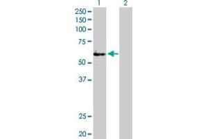 Western Blot analysis of FGFR1OP expression in transfected 293T cell line by FGFR1OP MaxPab polyclonal antibody.