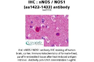 Image no. 1 for anti-Nitric Oxide Synthase 1, Neuronal (NOS1) (AA 1422-1433) antibody (ABIN5693644)