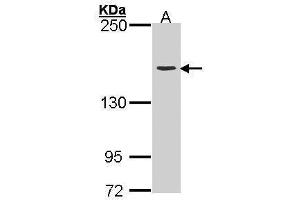 WB Image Sample (30 ug of whole cell lysate) A: H1299 5% SDS PAGE antibody diluted at 1:3000
