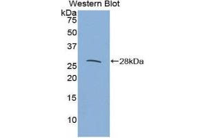 Image no. 1 for anti-Interleukin 27 Receptor, alpha (IL27RA) (AA 123-343) antibody (ABIN1859410)