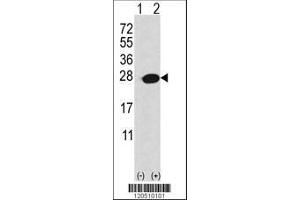 anti-Adenine Phosphoribosyltransferase (APRT) (AA 143-170), (C-Term) antibody