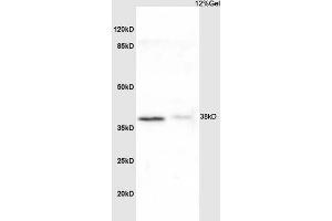 Image no. 2 for anti-NADH Dehydrogenase (Ubiquinone) 1 alpha Subcomplex, 8, 19kDa (NDUFA8) (AA 101-172) antibody (ABIN751723)