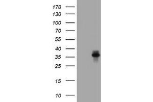 Image no. 2 for anti-Asialoglycoprotein Receptor 2 (ASGR2) antibody (ABIN1496744)
