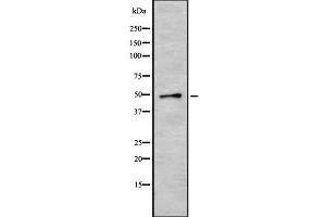 anti-Cytokine Receptor-Like Factor 3 (CRLF3) (Internal Region) antibody