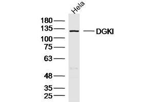 Image no. 1 for anti-Diacylglycerol Kinase, iota (DGKI) (AA 101-200) antibody (ABIN5675014)