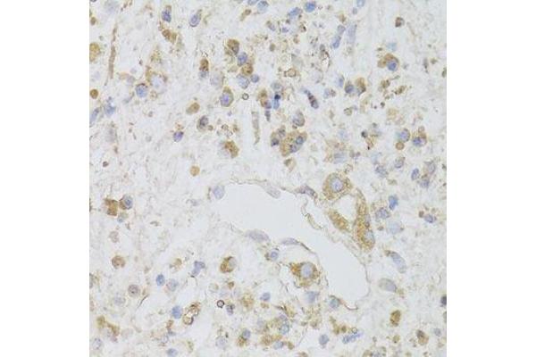 CIAPIN1 antibody  (AA 1-312)