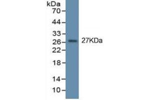 Mouse Capture antibody from the kit in WB with Positive Control: Eukaryotic TNFa protein.