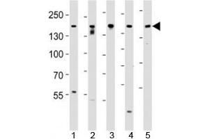 Image no. 3 for anti-Tuberous Sclerosis 2 (TSC2) (AA 1776-1805) antibody (ABIN3029331)
