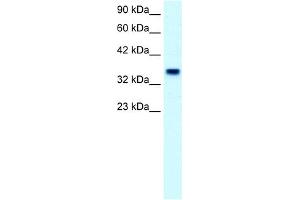Image no. 2 for anti-Forkhead Box F1 (FOXF1) (C-Term) antibody (ABIN2779550)