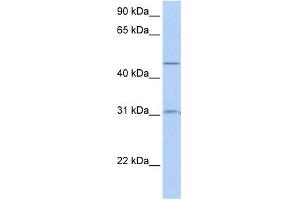 WB Suggested Anti-SLC39A11 Antibody Titration:  0.