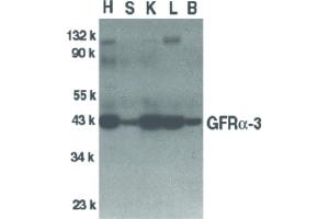 Image no. 1 for anti-GDNF Family Receptor alpha 3 (GFRA3) (Internal Region) antibody (ABIN6657688)