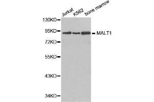 Image no. 1 for anti-Mucosa Associated Lymphoid Tissue Lymphoma Translocation Gene 1 (MALT1) antibody (ABIN3023032)