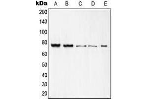 Image no. 2 for anti-REL proto-oncogene (c-Rel) (C-Term) antibody (ABIN2704553)