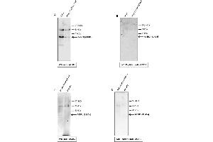 Image no. 2 for anti-Alkaline Ceramidase 1 (ACER1) (C-Term) antibody (ABIN2788591)
