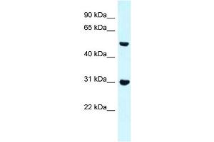 anti-Formin Binding Protein 1 (FNBP1) (N-Term) antibody