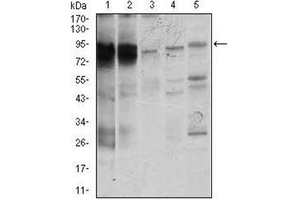 STAT5A Antikörper  (AA 583-794)