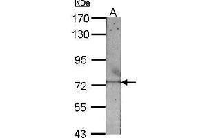 Image no. 5 for anti-RecQ Protein-Like (DNA Helicase Q1-Like) (RECQL) (C-Term) antibody (ABIN2857057)