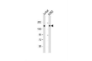 Image no. 4 for anti-Topoisomerase (DNA) II alpha 170kDa (TOP2A) (AA 1167-1196), (C-Term) antibody (ABIN653195)