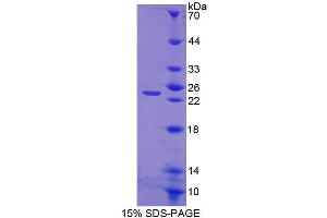 Image no. 1 for Chondrolectin (CHODL) (AA 48-214) protein (His tag) (ABIN6238955)