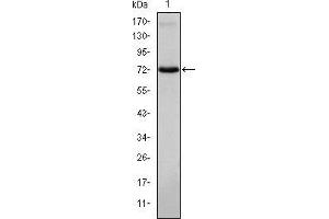 Image no. 3 for anti-IL2-Inducible T-Cell Kinase (ITK) antibody (ABIN969222)