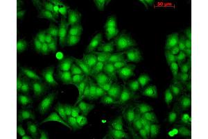 Image no. 2 for anti-Heat Shock 22kDa Protein 8 (HSPB8) antibody (PE) (ABIN2486746)