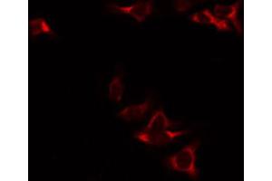 Image no. 2 for anti-NAD Dependent Malate Dehydrogenase (NAD-ME) antibody (ABIN6263183)