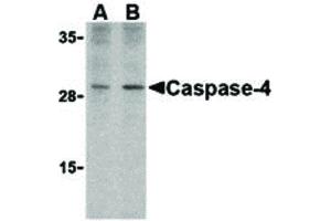 Image no. 1 for anti-Caspase 4, Apoptosis-Related Cysteine Peptidase (CASP4) (Internal Region) antibody (ABIN6655458)