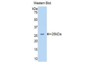 Western Blotting (WB) image for anti-phosphorylase, Glycogen, Liver (PYGL) (AA 73-267) antibody (ABIN1860384)