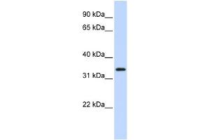 anti-Protein Kinase Protein SgK196 (SGK196) (N-Term) antibody