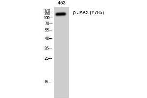 Image no. 1 for anti-Janus Kinase 3 (JAK3) (pTyr785) antibody (ABIN3182638)
