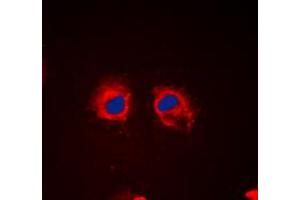 Immunofluorescent analysis of Cortactin (pY466) staining in HeLa cells.