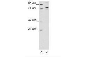 Image no. 1 for anti-TOX High Mobility Group Box Family Member 4 (TOX4) (N-Term) antibody (ABIN307424)