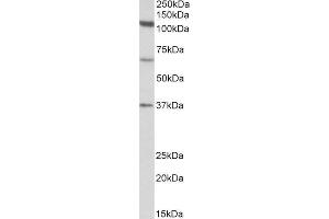 Image no. 1 for anti-Centriolar Coiled Coil Protein 110kDa (CCP110) (N-Term) antibody (ABIN1590090)