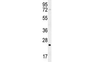 Image no. 4 for anti-HRas proto-oncogene, GTPase (HRAS) (AA 146-176) antibody (ABIN3031138)