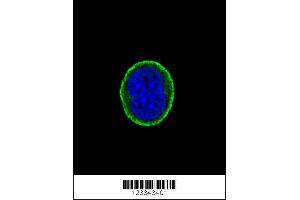 Image no. 2 for anti-Interleukin 10 Receptor, alpha (IL10RA) antibody (ABIN2487851)