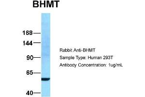 Image no. 2 for anti-Betaine--Homocysteine S-Methyltransferase (BHMT) (N-Term) antibody (ABIN2773785)