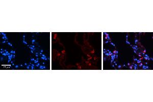 Image no. 6 for anti-Signal Transducer and Activator of Transcription 6, Interleukin-4 Induced (STAT6) (C-Term) antibody (ABIN2777200)