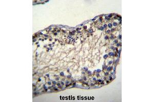 Image no. 1 for anti-Testis-Specific Serine Kinase 6 (TSSK6) (AA 24-54), (N-Term) antibody (ABIN955366)