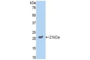 Image no. 5 for Growth Arrest-Specific 6 (GAS6) ELISA Kit (ABIN6730934)